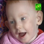 Лечение Вики Гагилевой