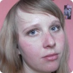 Препарат "Траклир" для Елены Морозовой