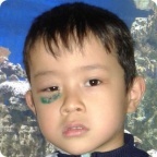 Оплачен счет за лечение Адиля Субучина