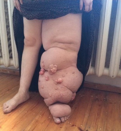 Хадижат Пирмагомедова