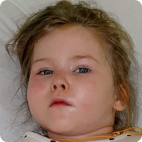 Курс реабилитации Даши Хомяковой