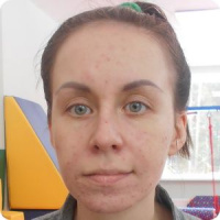 Вертикализатор для Светланы Резчиковой