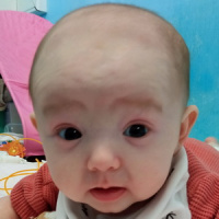 Инфузионные насосы для Лилианы Гатиятуллиной